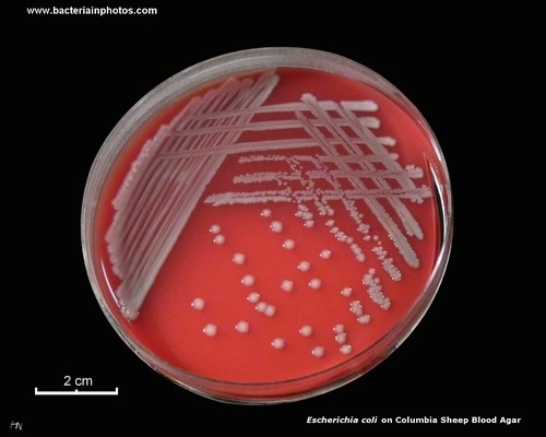 columbia sheep blood agar